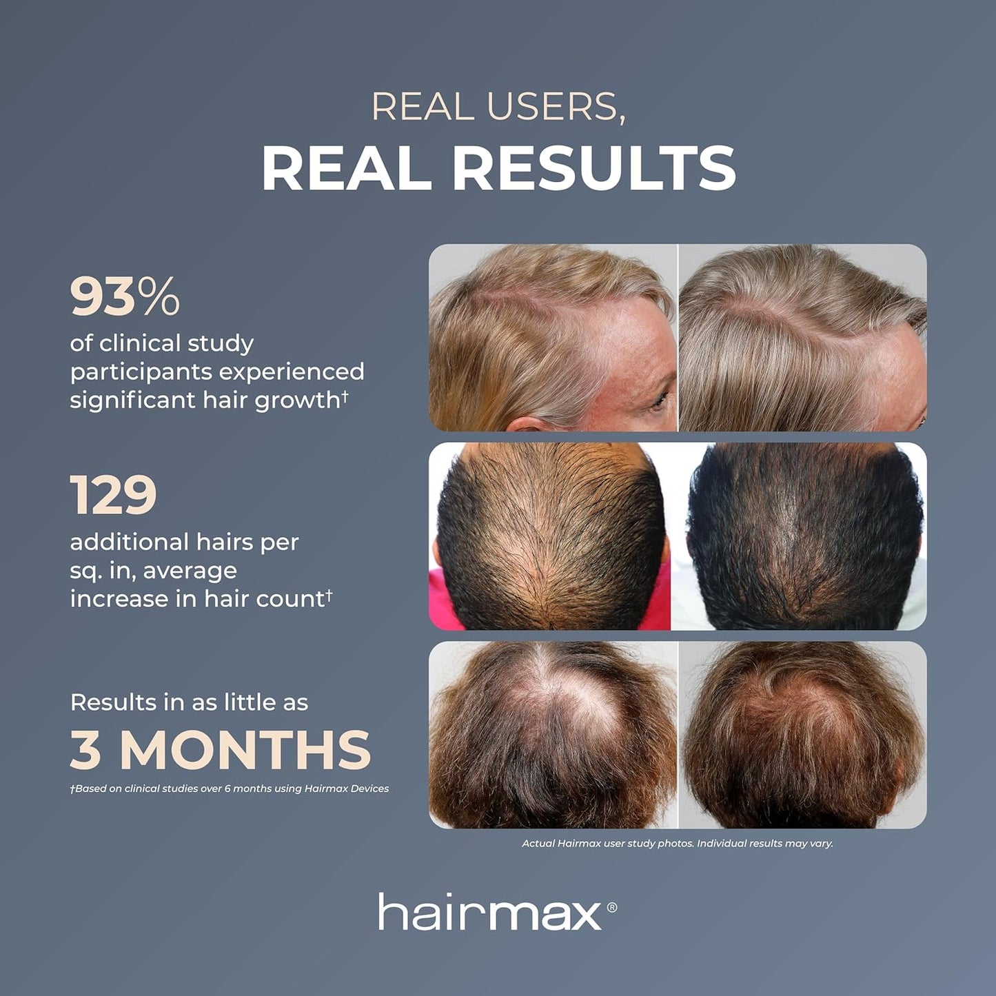 HairMax ULTIMA 12 LaserComb - Stimulates Hair Growth