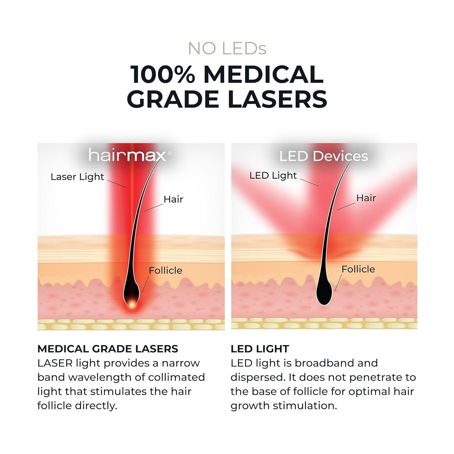 HairMax ULTIMA 12 LaserComb - Stimulates Hair Growth