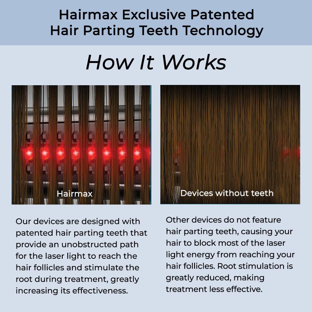 HairMax ULTIMA 12 LaserComb - Stimulates Hair Growth