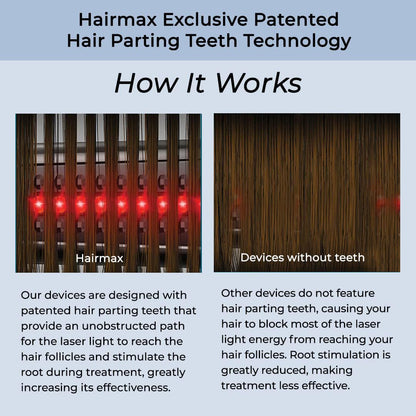 HairMax ULTIMA 12 LaserComb - Stimulates Hair Growth
